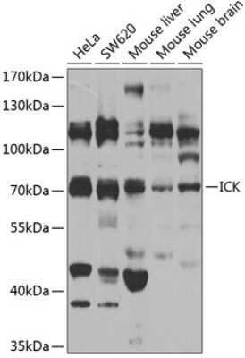Western Blot: ICK AntibodyBSA Free [NBP3-04614]
