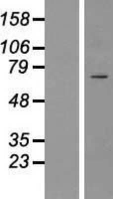 Western Blot: ICK Overexpression Lysate [NBP2-07246]