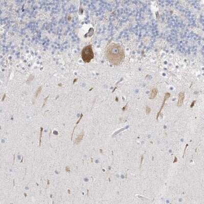 Immunohistochemistry-Paraffin: ICMT Antibody [NBP2-38198]