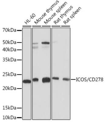 Western Blot: ICOS Antibody (7H1F7) [NBP3-16568]