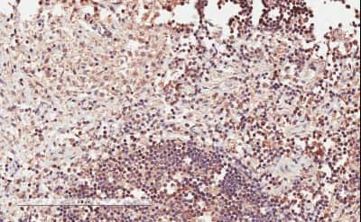 Immunohistochemistry-Paraffin: ICOS Antibody [NBP1-52139]
