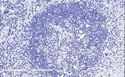 Immunohistochemistry-Paraffin: ICOS Antibody [NBP1-52139]