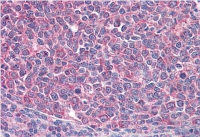 Immunohistochemistry-Paraffin: ICOS Antibody [NBP1-52139]