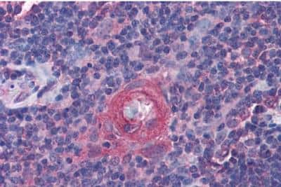 Immunohistochemistry-Paraffin: ICOS Antibody [NBP1-52139]