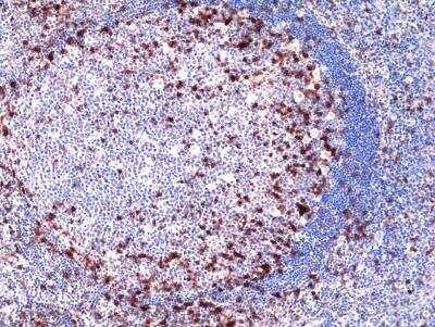 Immunohistochemistry-Paraffin: ICOS Antibody (RM417) [NBP2-89090]