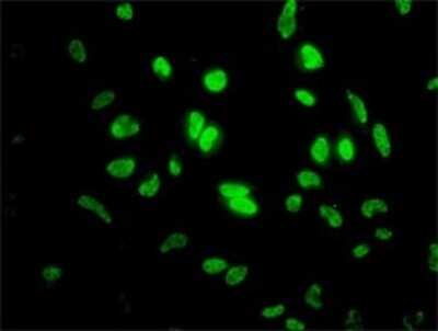 Immunocytochemistry/ Immunofluorescence: ID1 Antibody (1F7) [H00003397-M02]