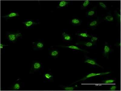 Immunocytochemistry/ Immunofluorescence: ID1 Antibody (3A9) [H00003397-M10]