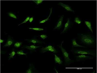 Immunocytochemistry/ Immunofluorescence: ID1 Antibody (3F3) [H00003397-M14]