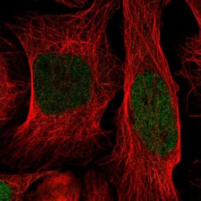 Immunocytochemistry/ Immunofluorescence: ID1 Antibody [NBP2-55521]