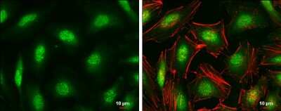 Immunocytochemistry/ Immunofluorescence: ID1 Antibody [NBP3-13286]