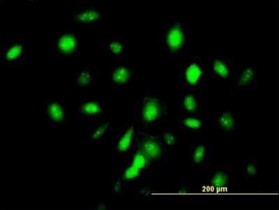 Immunocytochemistry/ Immunofluorescence: ID3 Antibody (2H8) [H00003399-M03]