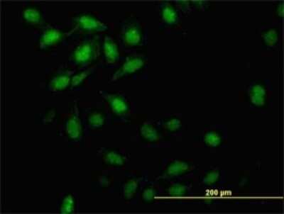 Immunocytochemistry/ Immunofluorescence: ID3 Antibody (3E10) [H00003399-M02]