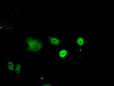 Immunocytochemistry/ Immunofluorescence: ID3 Antibody (OTI8B3) [NBP2-02136]