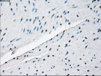 Immunohistochemistry-Paraffin: ID3 Antibody (OTI8B3) [NBP2-02136]