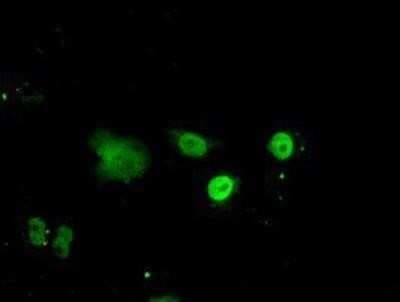 Immunocytochemistry/ Immunofluorescence: ID3 Antibody (OTI8B3) - Azide and BSA Free [NBP2-70979]