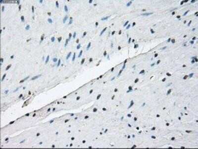 Immunohistochemistry: ID3 Antibody (OTI8B3) - Azide and BSA Free [NBP2-70979]