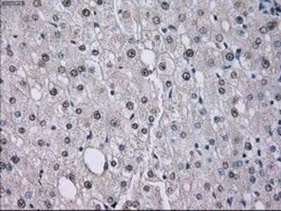 Immunohistochemistry: ID3 Antibody (OTI8B3) - Azide and BSA Free [NBP2-70979]