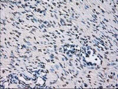 Immunohistochemistry: ID3 Antibody (OTI8B3) - Azide and BSA Free [NBP2-70979]