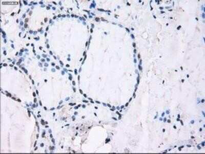 Immunohistochemistry: ID3 Antibody (OTI8B3) - Azide and BSA Free [NBP2-70979]