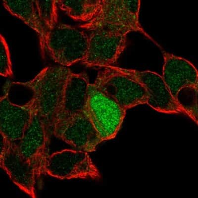 Immunocytochemistry/ Immunofluorescence: ID4 Antibody [NBP2-56322]