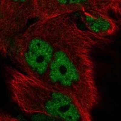 Immunocytochemistry/ Immunofluorescence: ID4 Antibody [NBP3-17869]