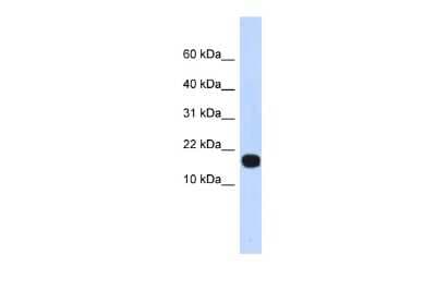 Western Blot: ID4 Antibody [NBP3-10934]