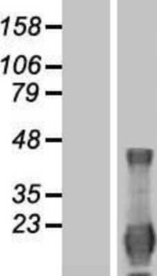 Western Blot: ID4 Overexpression Lysate [NBP2-08195]
