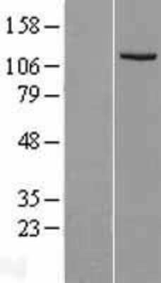 Western Blot: Insulysin/IDE Overexpression Lysate [NBL1-11816]