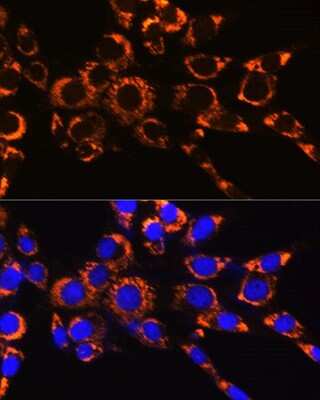Immunocytochemistry/ Immunofluorescence: IDH2 Antibody (8C3D4) [NBP3-15366]