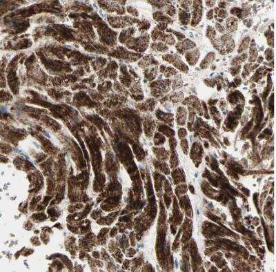 Immunohistochemistry-Paraffin: IDH2 Antibody [NBP1-85784]