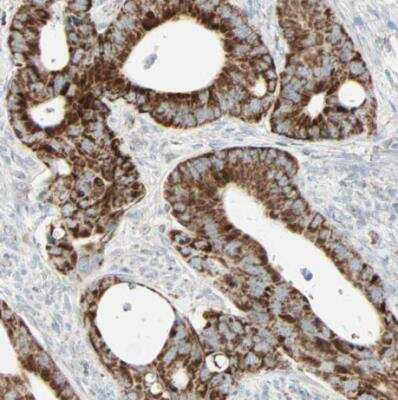 Immunohistochemistry-Paraffin: IDH2 Antibody [NBP1-85784]