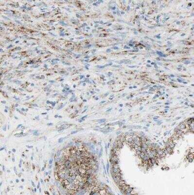 Immunohistochemistry-Paraffin: IDH2 Antibody [NBP1-85784]