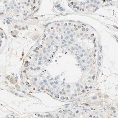 Immunohistochemistry-Paraffin: IDH2 Antibody [NBP1-85784]