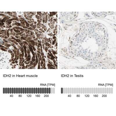 Immunohistochemistry-Paraffin: IDH2 Antibody [NBP1-85784]