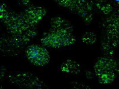 Immunocytochemistry/ Immunofluorescence: IDH3A Antibody (OTI2F11) [NBP2-02158]