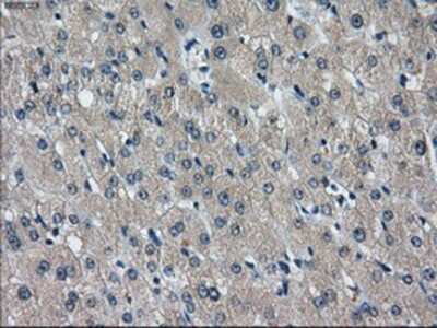 Immunohistochemistry-Paraffin: IDH3A Antibody (OTI2F11) [NBP2-02158]