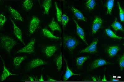 Immunocytochemistry/ Immunofluorescence: IDH3A Antibody [NBP1-32396]
