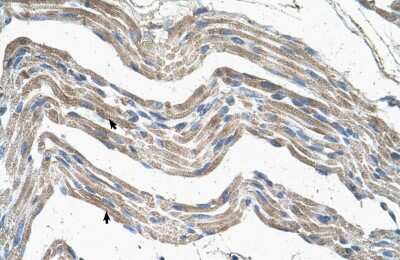 Immunohistochemistry-Paraffin: IDH3A Antibody [NBP1-54736]