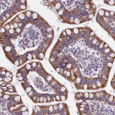 Immunohistochemistry-Paraffin: IDH3A Antibody [NBP1-85840]
