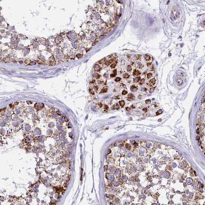 Immunohistochemistry-Paraffin: IDH3A Antibody [NBP1-85840]
