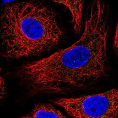 Immunocytochemistry/ Immunofluorescence: IDH3B Antibody [NBP2-58706]