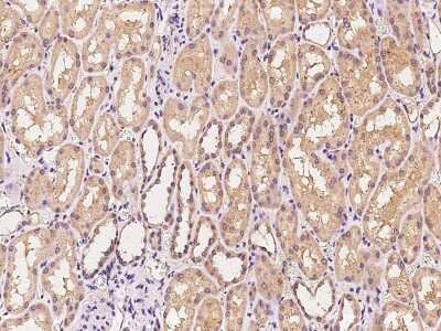 Immunohistochemistry-Paraffin: IDH3B Antibody [NBP2-97467]