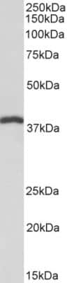 Western Blot: IDH3B Antibody [NBP1-78787]