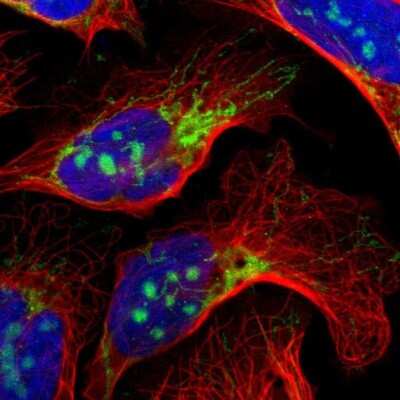 Immunocytochemistry/ Immunofluorescence: IDH3G Antibody [NBP1-85810]