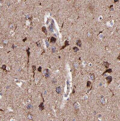 Immunohistochemistry-Paraffin: IDH3G Antibody [NBP1-85810]
