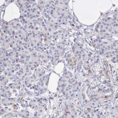Immunohistochemistry-Paraffin: IDH3G Antibody [NBP1-85824]