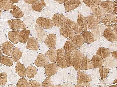 Immunohistochemistry-Paraffin: IDI2 Antibody [NBP2-97025]