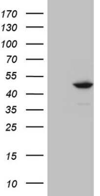 Western Blot: IDO2 Antibody (OTI11B2) [NBP2-46021]
