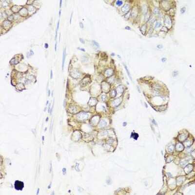 Immunohistochemistry-Paraffin: IER3 Antibody - BSA Free [NBP3-03948]