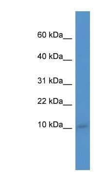 Western Blot: IER3IP1 Antibody [NBP1-91302]